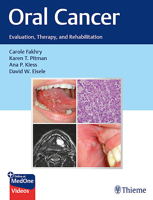 Oral Cancer, Ana P. Kiess, Carole Fakhry, Karen T. Pitman