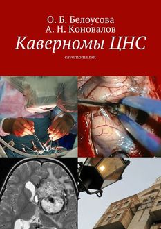 Каверномы ЦНС, А.Н. Коновалов, Д.Н. Окишев, О.Б. Белоусова