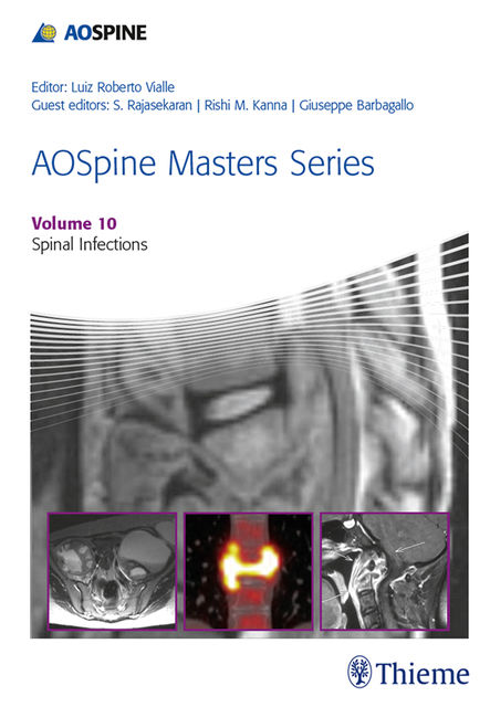 AOSpine Masters Series, Volume 10: Spinal Infections, Luiz Roberto Vialle, Giuseppe Barbagallo, Rishi M. Kanna, S. Rajasekaran
