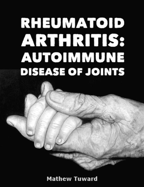 Rheumatoid Arthritis: Autoimmune Disease of Joints, Mathew Tuward