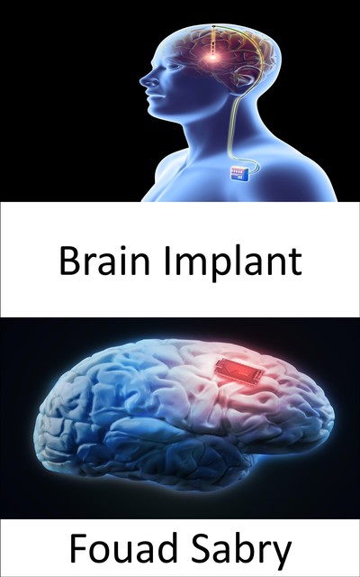 Brain Implant, Fouad Sabry