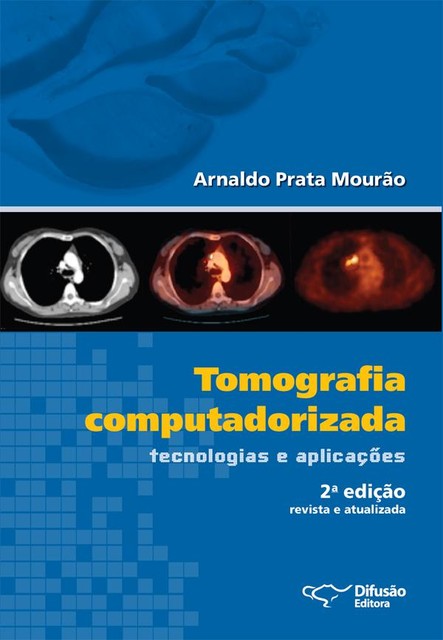 Tomografia computadorizada, Arnaldo Prata Mourão