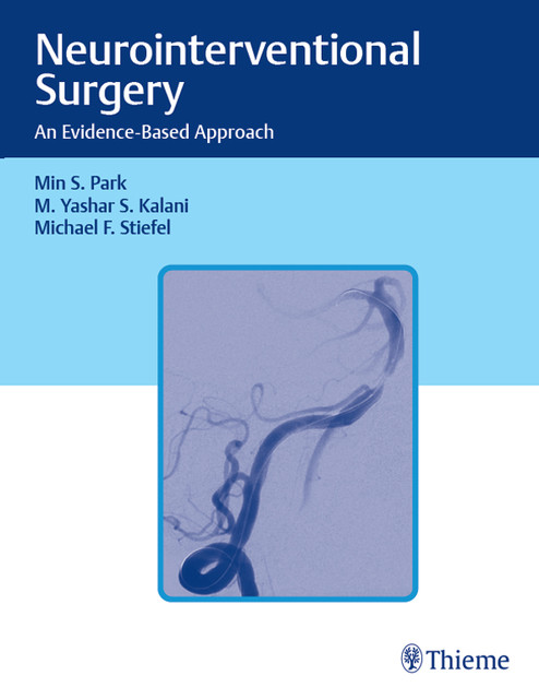Neurointerventional Surgery, M.Yashar S.Kalani, Min S. Park, Michael F. Stiefel