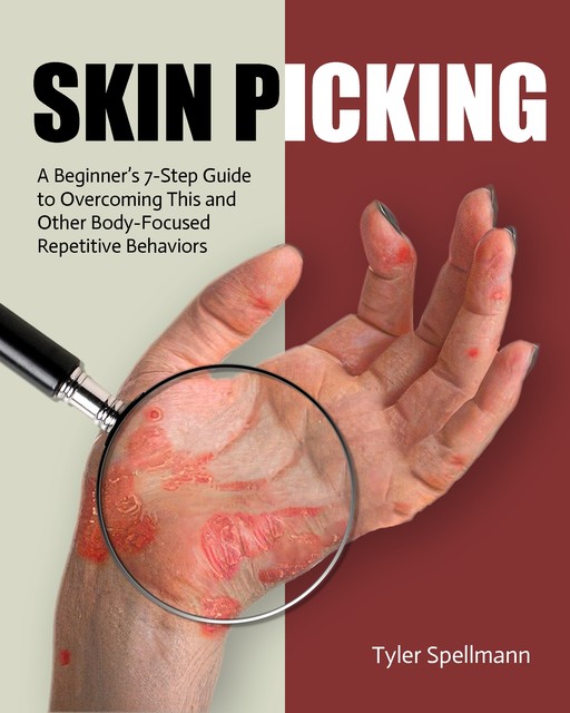 Skin Picking, Tyler Spellmann