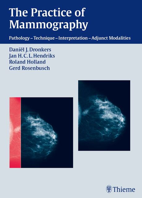Practice of Mammography, Daniël J.Dronkers, Gerd Rosenbusch, Jan H.C.L.Hendriks, Roland Holland