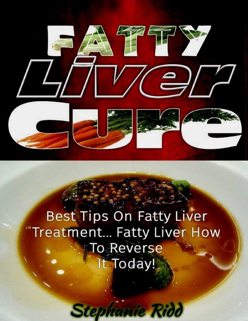 Fatty Liver Cure: Best Tips On Fatty Liver Treatment Fatty Liver How to Reverse It Today!, Stephanie Ridd