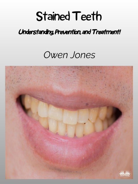 Stained Teeth-Understanding, Prevention, And Treatment, Owen Jones