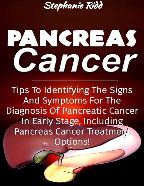 Pancreas Cancer: Tips to Identifying the Signs and Symptoms to Diagnosis Pancreatic Cancer At Early Stages, Including Pancreas Cancer Treatment Options!, Stephanie Ridd