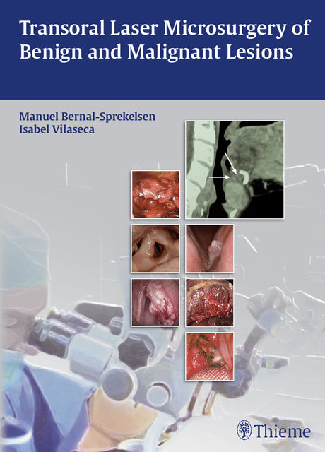 Transoral Laser Microsurgery of Benign and Malignant Lesions, Manuel Bernal-Sprekelsen, Isabel Vilaseca