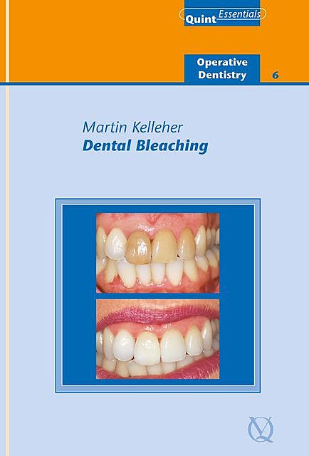 Dental Bleaching, Martin Kelleher