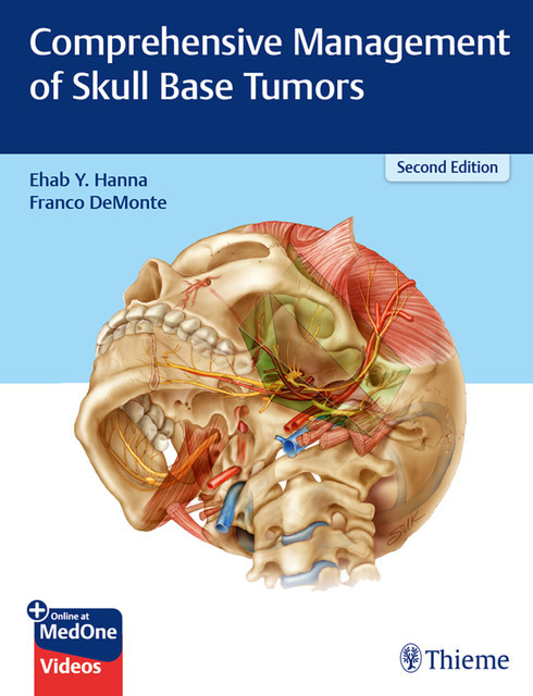 Comprehensive Management of Skull Base Tumors, Franco DeMonte, Ehab Hanna