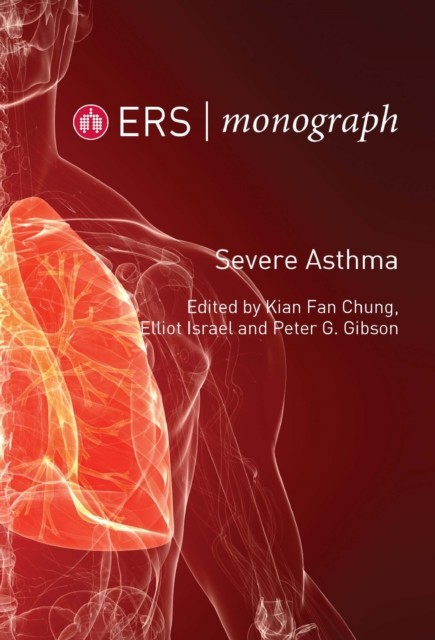 Severe Asthma, Peter Gibson, Elliot Israel, Kian Fan Chung