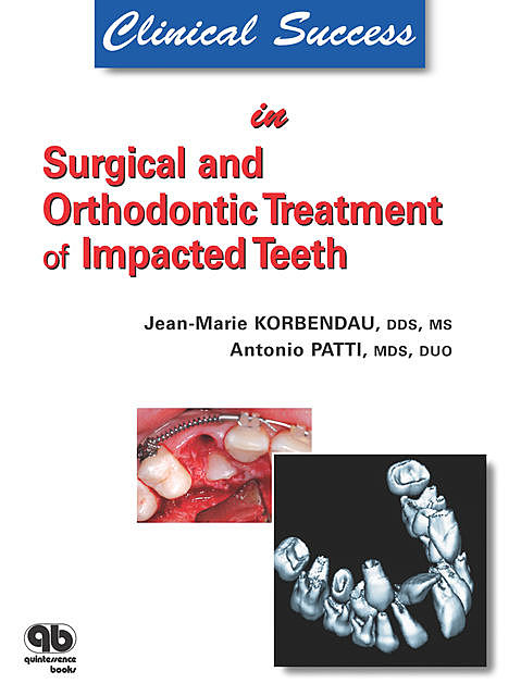 Clinical Success in Surgical and Orthodontic Treatment of Impacted Teeth, Antonio Patti, Jean-Marie Korbendau