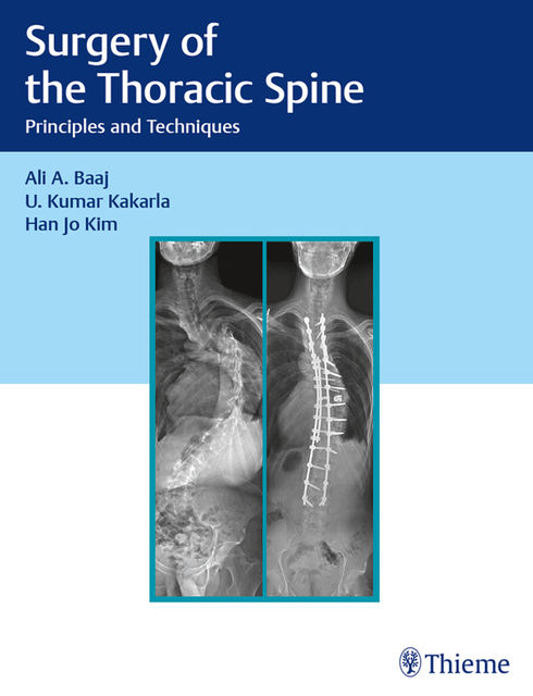 Surgery of the Thoracic Spine, Ali A.Baaj, Han Jo Kim, U. Kumar Kakarla