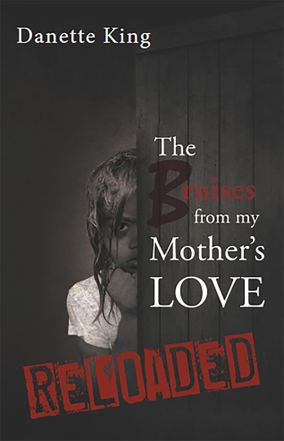 The Bruises from my Mother's Love, Danette King
