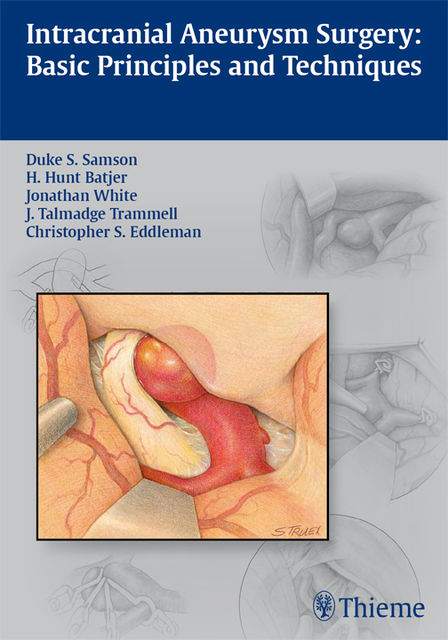 Intracranial Aneurysm Surgery, Christopher S.Eddleman, Duke S.Samson, H.Hunt Batjer, J.Talmadge Trammell, Jonathan White