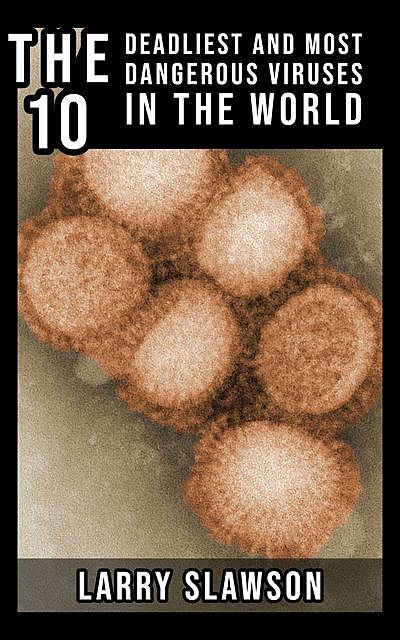 The 10 Deadliest and Most Dangerous Viruses in the World, Larry Slawson
