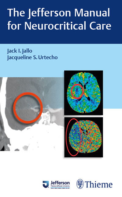 The Jefferson Manual for Neurocritical Care, Jack Jallo, Jacqueline S. Urtecho
