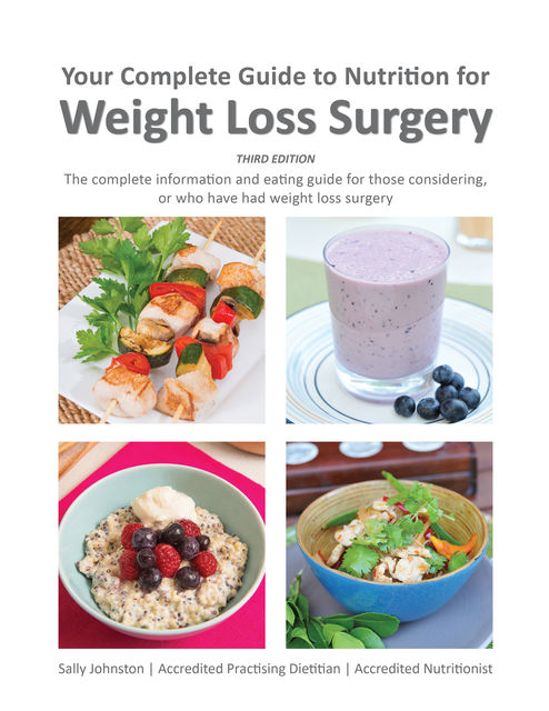 Your Complete Guide to Nutrition for Weight Loss Surgery, Sally Johnston