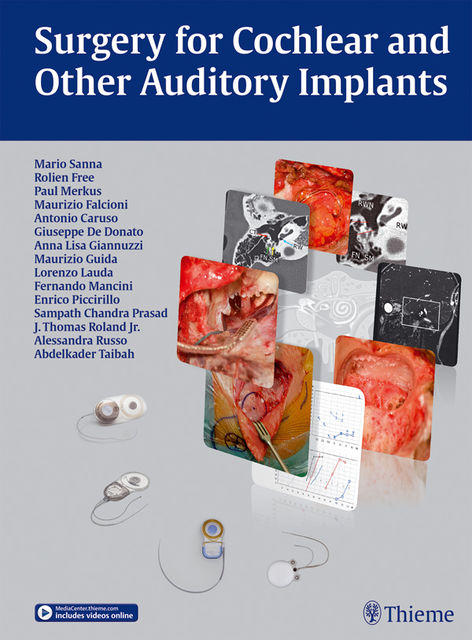 Surgery for Cochlear and Other Auditory Implants, Mario Sanna, Paul Merkus, Rolien H. Free
