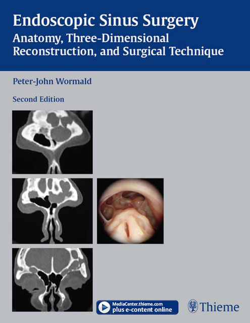 Endoscopic Sinus Surgery, Peter-John Wormald