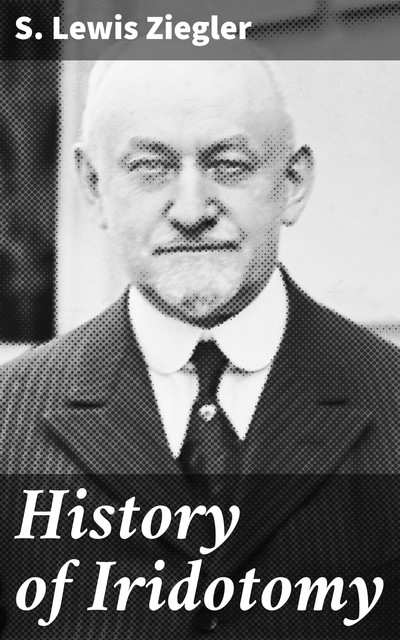 History of Iridotomy, S. Lewis Ziegler