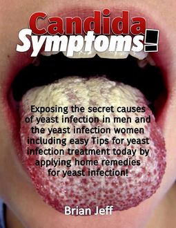 Candida Symptoms! : Exposing the Secret Causes of Yeast Infection In Men and Women Including the Easy Tips for Yeast Infection Treatment Today By Applying Home Remedies for Yeast Infection, Brian Jeff
