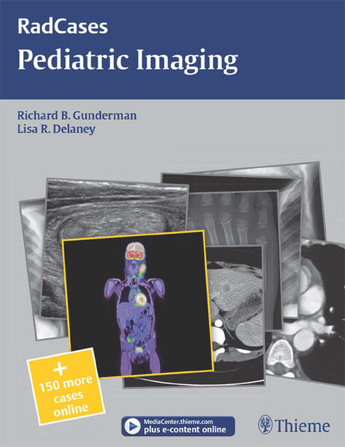 Pediatric Imaging, Lisa R.Delaney, Richard B.Gunderman