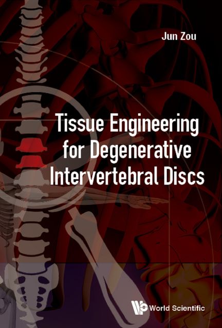 Tissue Engineering for Degenerative Intervertebral Discs, Jun Zou