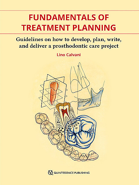 Fundamentals of Treatment Planning, Lino Calvani