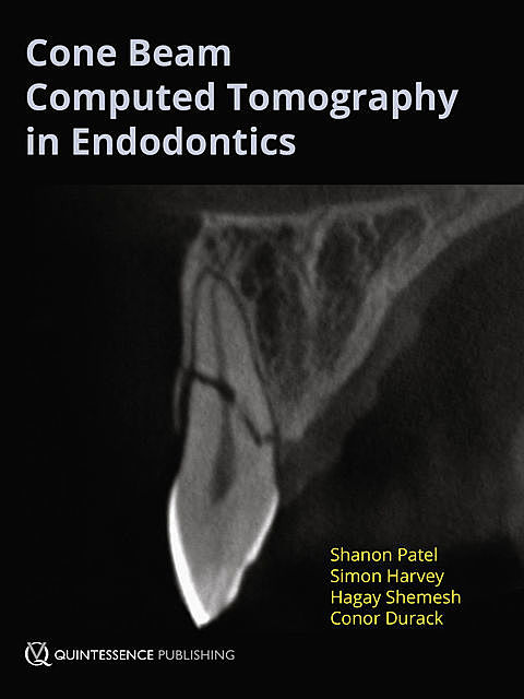 Cone Beam Computed Tomography in Endodontics, Conor Durack, Hagay Shemesh, Shanon Patel, Simon Harvey