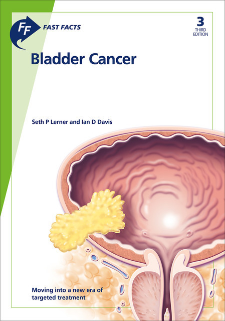 Fast Facts: Bladder Cancer, I.D. Davis, S.P. Lerner