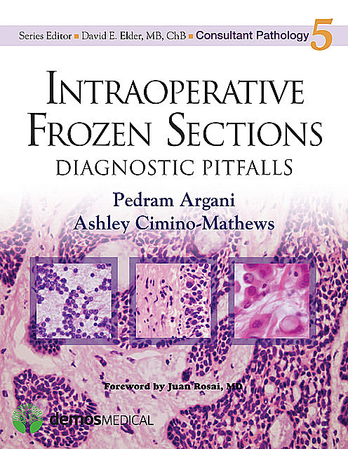 Intraoperative Frozen Sections, Ashley Cimino-Mathews, Pedram Argani