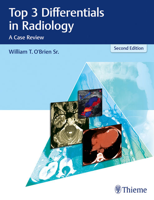 Top 3 Differentials in Radiology, William O'Brien