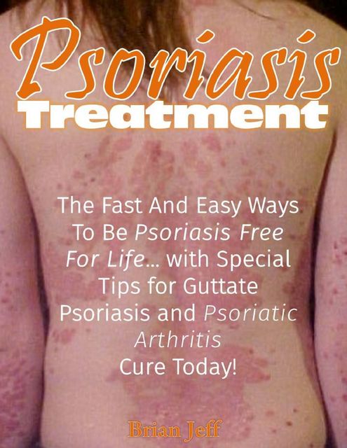 Psoriasis Treatment: The Fast and Easy Ways to Be Psoriasis Free for Life With Special Tips for Guttate Psoriasis and Psoriatic Arthritis Cure Today, Brian Jeff