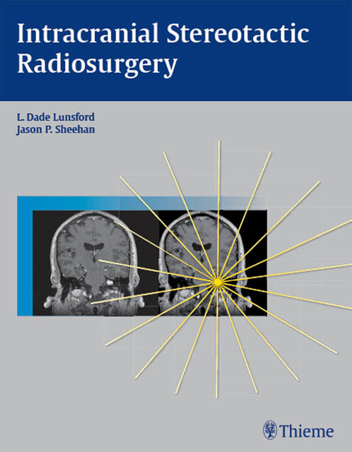 Intracranial Stereotactic Radiosurgery, L.Dade Lunsford, Jason Sheehan