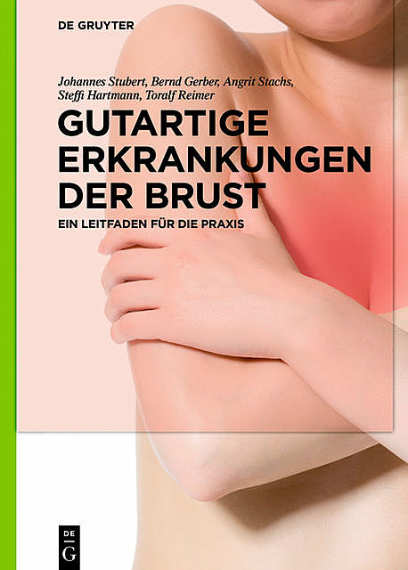 Gutartige Erkrankungen der Brust, Toralf Reimer, Angrit Stachs, Bernd Gerber, Johannes Stubert, Steffi Hartmann