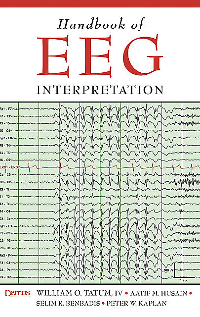 Handbook of EEG Interpretation, DO, Peter W. Kaplan, Aatif M. Husain, Selim R. Benbadis, William O. Tatum