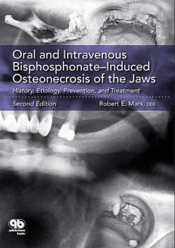 Oral and Intravenous Bisphosphonate–Induced Osteonecrosis of the Jaws, Robert E. Marx