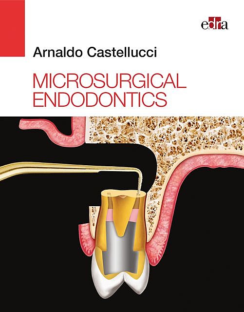 Microsurgical Endodontics, Arnaldo Castellucci