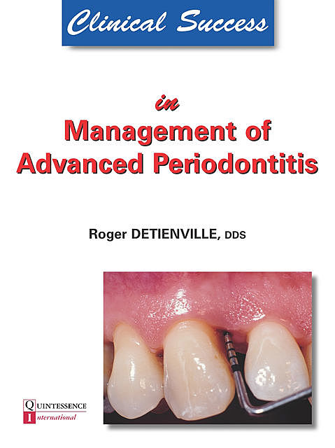 Clinical Success in Management of Advanced Periodontitis, Roger Detienville