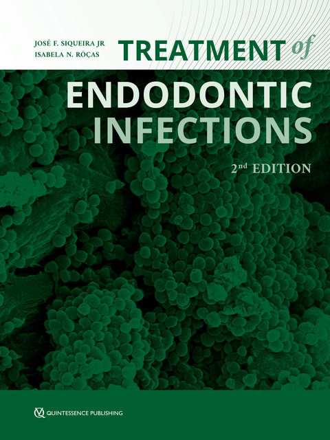 Treatment of Endodontic Infections, Isabela N. Rôças, José F. Siqueira Jr
