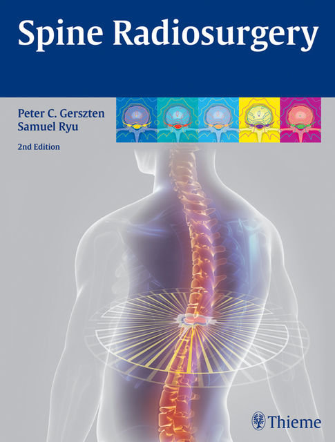 Spine Radiosurgery, Peter C., Samuel Ryu, Gerszten