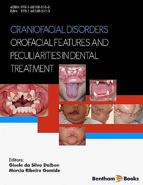 Craniofacial Disorders – Orofacial Features and Peculiarities in Dental Treatment, Gisele da Silva Dalben, Marcia Ribeiro Gomide