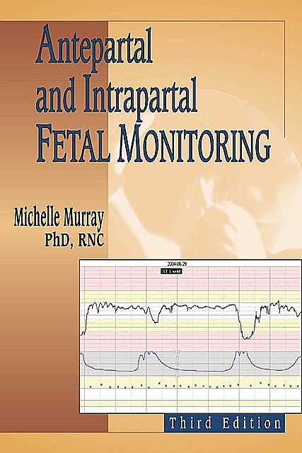 Antepartal and Intrapartal Fetal Monitoring, RNC, Michelle Murray