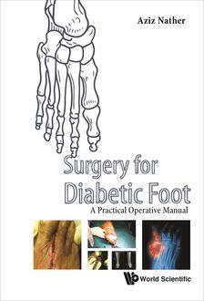 Surgery for Diabetic Foot, Aziz Nather