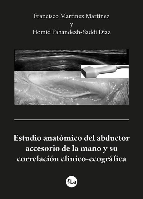 Estudio anatómico del abductor accesorio de la mano y su correlación clínico-ecográfica, Francisco Martínez Martínez, Homid Fahandezh-Saddi Díaz