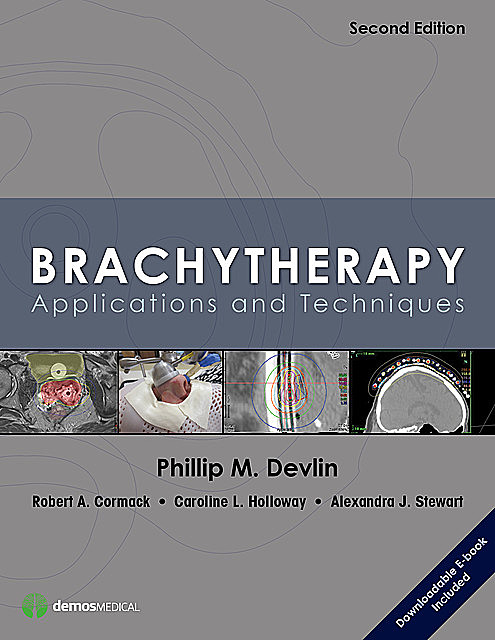 Brachytherapy, Alexandra Stewart, Caroline L. Holloway, Phillip M. Devlin, Robert A. Cormack