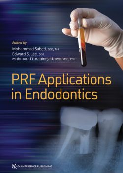 PRF Applications in Endodontics, Edward Lee, Mahmoud Torabinejad, Mohammad Sabeti
