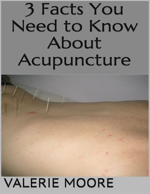 3 Facts You Need to Know About Acupuncture, Valerie Moore